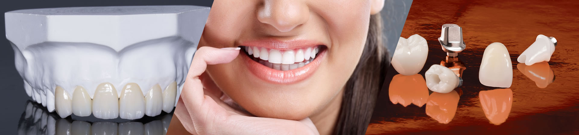 images Axi Dental Lab axi dental lab it s no accident that