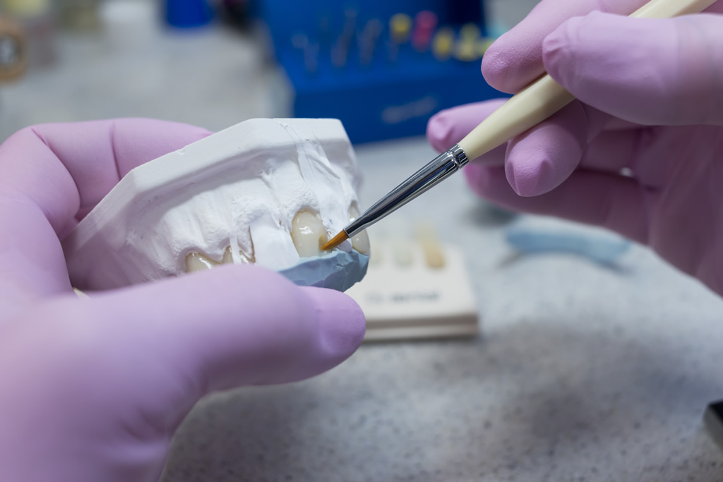 images Axi Dental Lab thermal exposure